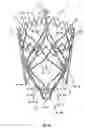 Fig. 32 - Stent for the positioning and anchoring of a valvular prosthesis in an implantation site in the heart of a patient
