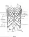 Fig. 34 - Stent for the positioning and anchoring of a valvular prosthesis in an implantation site in the heart of a patient