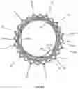 Fig. 48 - Stent for the positioning and anchoring of a valvular prosthesis in an implantation site in the heart of a patient
