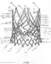 Fig. 52 - Stent for the positioning and anchoring of a valvular prosthesis in an implantation site in the heart of a patient