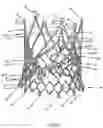 Fig. 53 - Stent for the positioning and anchoring of a valvular prosthesis in an implantation site in the heart of a patient