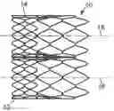 Fig. 01 - Stented heart valve devices and methods for atrioventricular valve replacement