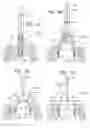 Fig. 08 - Implant for heart valve