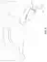 Fig. 11 - Interbody fusion device