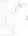 Fig. 12 - Interbody fusion device