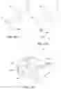 Fig. 14 - Interbody fusion device
