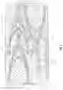 Fig. 02 - Surgical trays, instruments and methods for removing components of a hip replacement prosthesis