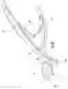 Fig. 16 - Surgical trays, instruments and methods for removing components of a hip replacement prosthesis