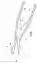 Fig. 17 - Surgical trays, instruments and methods for removing components of a hip replacement prosthesis
