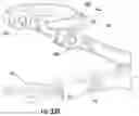 Fig. 18 - Surgical trays, instruments and methods for removing components of a hip replacement prosthesis