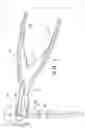 Fig. 19 - Surgical trays, instruments and methods for removing components of a hip replacement prosthesis