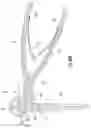 Fig. 20 - Surgical trays, instruments and methods for removing components of a hip replacement prosthesis