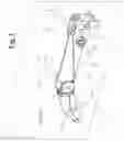 Fig. 02 - Prosthetic hand system