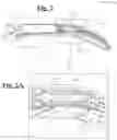 Fig. 03 - Prosthetic hand system