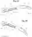 Fig. 04 - Prosthetic hand system