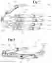 Fig. 08 - Prosthetic hand system