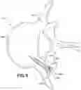 Fig. 07 - Magnetic core bone screw