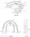 Fig. 06 - User-customizable orthopedic alignment device with alignment gap
