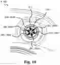 Fig. 10 - Sensor assembly part and a base plate for a medical appliance and a method for manufacturing a sensor assembly part and a base plate