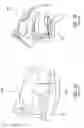 Fig. 02 - Methods and devices for treating sleep apnea