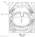 Fig. 03 - Methods and devices for treating sleep apnea