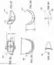 Fig. 13 - Methods and devices for treating sleep apnea