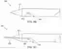 Fig. 17 - Methods and devices for treating sleep apnea