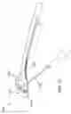 Fig. 20 - Methods and devices for treating sleep apnea