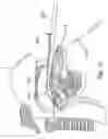 Fig. 23 - Methods and devices for treating sleep apnea