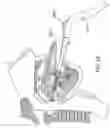 Fig. 30 - Methods and devices for treating sleep apnea