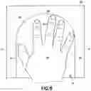 Fig. 06 - Cold Block for Decreasing Neuropathy During Chemotherapy