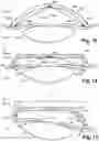 Fig. 08 - Ophthalmic device for treating an eye
