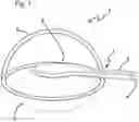 Fig. 02 - Capsulotomy device