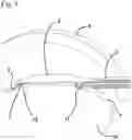 Fig. 03 - Capsulotomy device
