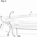 Fig. 09 - Capsulotomy device