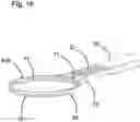Fig. 13 - Capsulotomy device