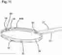 Fig. 14 - Capsulotomy device