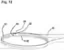 Fig. 15 - Capsulotomy device