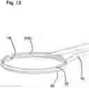 Fig. 16 - Capsulotomy device