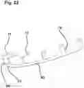 Fig. 25 - Capsulotomy device