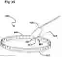 Fig. 28 - Capsulotomy device