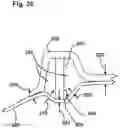 Fig. 29 - Capsulotomy device