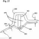Fig. 30 - Capsulotomy device