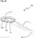 Fig. 31 - Capsulotomy device