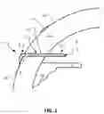 Fig. 02 - GLAUCOMA TREATMENT DEVICES AND METHODS