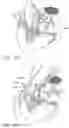 Fig. 09 - MINIMALLY INVASIVE GLAUCOMA SURGICAL INSTRUMENT AND METHOD