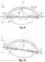 Fig. 07 - Ophthalmic Device For Treating An Eye