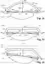 Fig. 09 - Ophthalmic Device For Treating An Eye