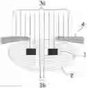 Fig. 01 - Device for creating an aperture in the eye
