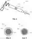 Fig. 06 - Systems and methods for preforming an intraocular procedure for treating an eye condition